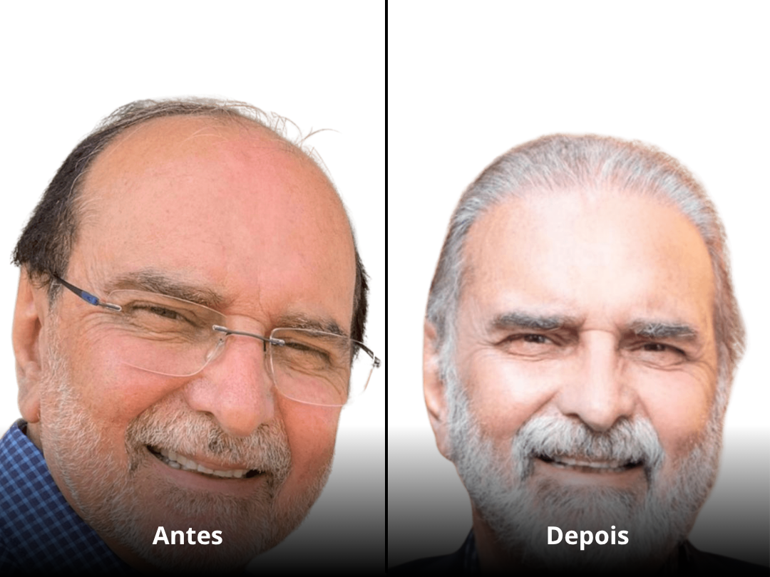 Resultado Antes e Depois